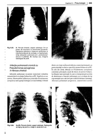 157414577-Esentialul-in-Pediatrie-Ciofu.pdf