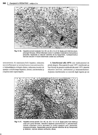 157414577-Esentialul-in-Pediatrie-Ciofu.pdf