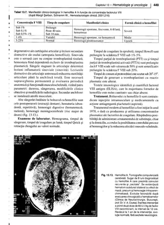 157414577-Esentialul-in-Pediatrie-Ciofu.pdf