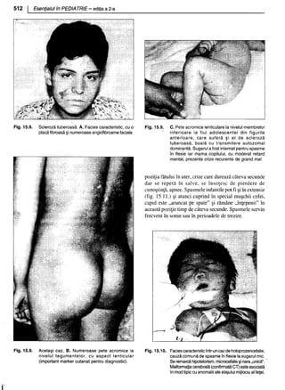 157414577-Esentialul-in-Pediatrie-Ciofu.pdf