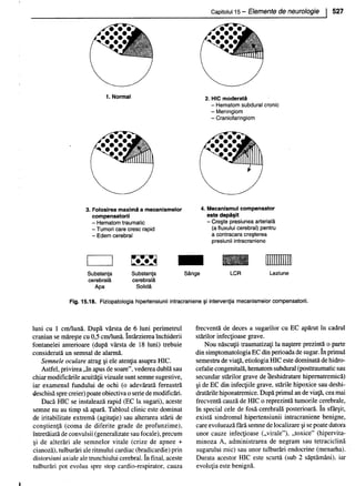 157414577-Esentialul-in-Pediatrie-Ciofu.pdf