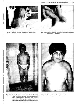 157414577-Esentialul-in-Pediatrie-Ciofu.pdf