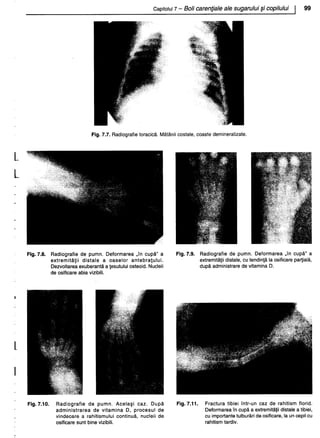 157414577-Esentialul-in-Pediatrie-Ciofu.pdf