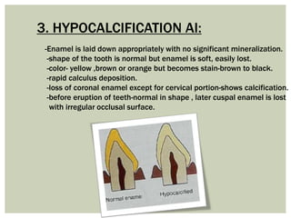 3. HYPOCALCIFICATION AI:
-Enamel is laid down appropriately with no significant mineralization.
-shape of the tooth is normal but enamel is soft, easily lost.
-color- yellow ,brown or orange but becomes stain-brown to black.
-rapid calculus deposition.
-loss of coronal enamel except for cervical portion-shows calcification.
-before eruption of teeth-normal in shape , later cuspal enamel is lost
with irregular occlusal surface.
 