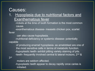 Causes:
1. Hypoplasia due to nutritional factors and
Exanthematous fever
-rickets at the time of tooth formation is the most common
cause.
-exanthematous disease- measels chicken pox, scarlet
fever
can also cause hypoplasia.
-nutritional deficiency or systemic disease- potentially
capable
of producing enamel hypoplasia- as ameloblast are one of
the most sensitive cells in terms of metabolic function.
-hypoplastic teeth- exhibit pitting variety staining of pits.
-teeth- frequently involved central & lateral incisors, 2nd &
3rd
molars are seldom affected.
-hypoplastic teeth appear to decay rapidly once caries is
initiated.
 