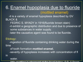 6. Enamel hypoplasia due to fluoride
(mottled enamel)
-it is a variety of enamel hypoplasia described by GV
BLACK &
FEDRIC S. MYADY in 1916(fluoride brown stain)
-it exhibit a geographic distribution and due to presence of
some substances in water supply.
-later the causative agent was found to be fluoride.
Etiology:
-ingestion of fluoride containing drinking water during the
time
of tooth formation-mottled enamel.
-severity of hypoplasia increases with concentration of fl
in
water.
 