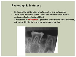 Radiographic features :
- Full or partial obliteration of pulp camber and pulp canals
- Teeth have a bulbous crown , roots are narrower than normal ,
roots can also be short and blunt.
- Appearance of Shell teeth – presence of normal enamel thickness,
extremely thin dentin and enormous pulp chamber.
 