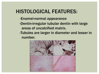 HISTOLOGICAL FEATURES:
-Enamel-normal appearance
-Dentin-irregular tubular dentin with large
areas of uncalcified matrix.
-Tubules are larger in diameter and lesser in
number.
 