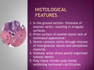 1. In the ground section- thickness of
enamel varies- resulting in irregular
surfaces.
2. Prism surface of enamel shows lack of
laminated appearance.
3. Dentin contains clefts through mixture
of interglobular dentin and amorphous
material.
4. Globular areas shows poorly organized
tubular dentin.
5. Pulp tissue contain pulp stones
exhibiting laminated calcification.
 