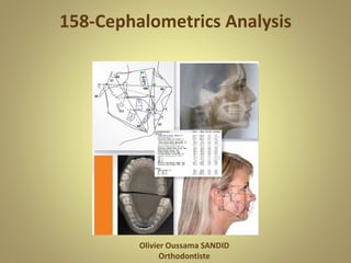 158-Cephalometrics Analysis
Olivier Oussama SANDID
Orthodontiste
 