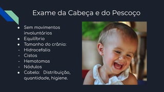 Exame da Cabeça e do Pescoço
● Sem movimentos
involuntários
● Equilíbrio
● Tamanho do crânio:
- Hidrocefalia
- Cistos
- Hematomas
- Nódulos
● Cabelo: Distribuição,
quantidade, higiene.
 