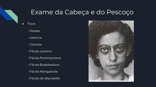 Exame da Cabeça e do Pescoço
● Face:
- Palidez
- Icterícia.
- Cianose
- Fácies Leonino
- Fácies Parkinsoniana
- Fácies Basedowiana
- Fácies Mongoloide
- Fácies de depressão
 