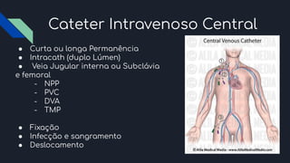 Cateter Intravenoso Central
● Curta ou longa Permanência
● Intracath (duplo Lúmen)
● Veia Jugular interna ou Subclávia
e femoral
- NPP
- PVC
- DVA
- TMP
● Fixação
● Infecção e sangramento
● Deslocamento
 