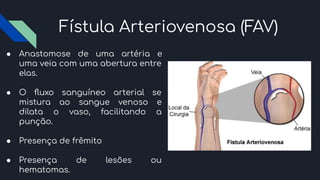 Fístula Arteriovenosa (FAV)
● Anastomose de uma artéria e
uma veia com uma abertura entre
elas.
● O ﬂuxo sanguíneo arterial se
mistura ao sangue venoso e
dilata o vaso, facilitando a
punção.
● Presença de frêmito
● Presença de lesões ou
hematomas.
 