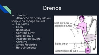 Drenos
● Torácico
-Remoção de ar, líquido ou
sangue no espaço pleural.
● Cuidados:
- Local
- Radiologia
- Controle SSVV
- Selo de água
- Aspecto do líquido
- Curativo
- Sinais Flogístico
- Borbulhamento
 