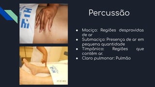 Percussão
● Maciço: Regiões desprovidas
de ar
● Submaciço: Presença de ar em
pequena quantidade
● Timpânico: Regiões que
contêm ar.
● Claro pulmonar: Pulmão
 