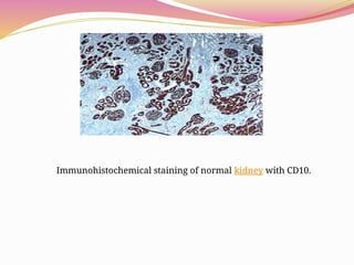 Immunohistochemical staining of normal kidney with CD10.
 