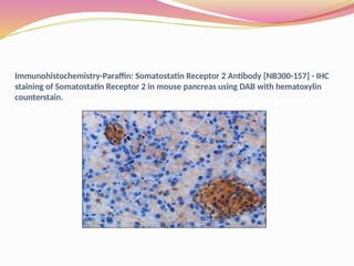Immunohistochemistry-Paraffin: Somatostatin Receptor 2 Antibody [NB300-157] - IHC
staining of Somatostatin Receptor 2 in mouse pancreas using DAB with hematoxylin
counterstain.
 
