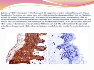 Detection of HDAC4 in human skin by IHC. Chromogenic IHC was performed on thin sections of human skin obtained
from biopsies. The sections were stained either with a rabbit polyclonal antibody against HDAC4 (Cat. No. PA1-863) or
without this antibody (the negative control). HDAC4 detection was performed using a biotinylated anti-rabbit IgG
secondary antibody and streptavidin-Horseradish peroxidase (HRP), followed by colorimetric detection using DAB. The
sections were then counterstained with hematoxylin and mounted under coverslips. In the left hand panel, above the
HDAC4 antigen is stained brown by the precipitated DAB reaction product. The control section on the right is not
stained brown because no anti-HDAC4 primary antibody was used. Only the blue hematoxylin counterstaining can be
seen
.
 