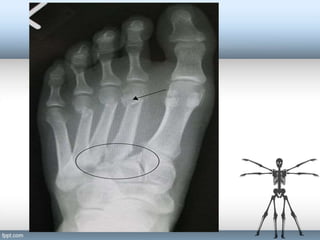 1588832907-orthopedic-injuries.pptx