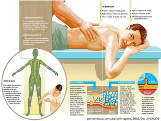 pernambuco.com/diario/imagens/2005/06/19/SAUDE
 