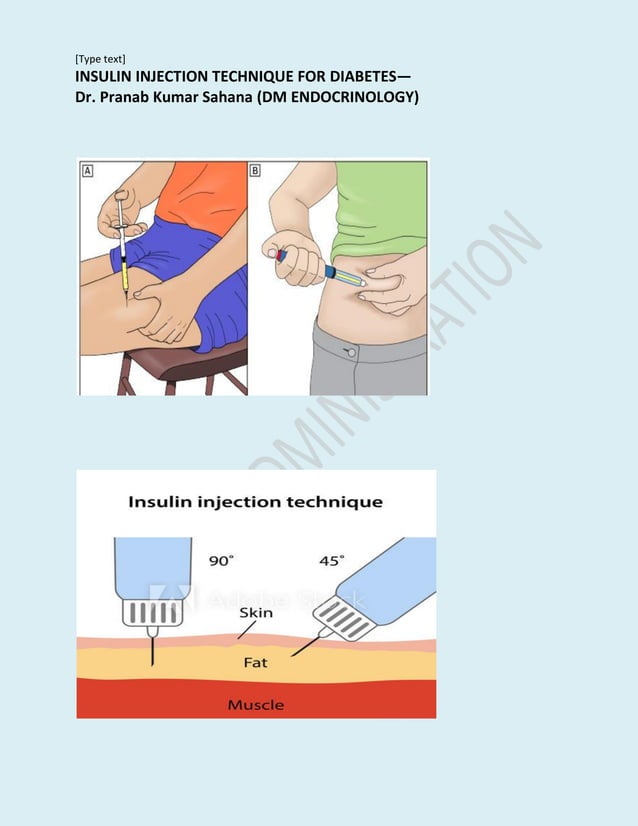 1592880638275 Insulin Injection Technique Pdf 1592880638275 Insulin Injection Technique Pdf
