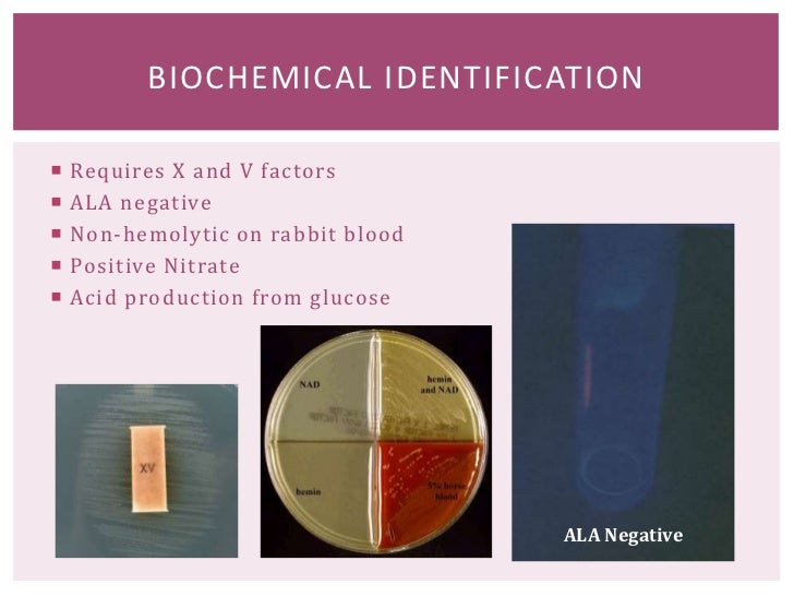 15a chapter_18__haemophilus_species