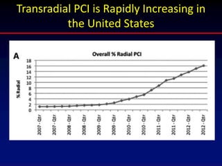 Transradial PCI is Rapidly Increasing in
the United States
 