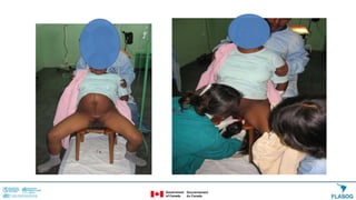 PUEDE PARARSE FÁCILMENTE.
SE PUEDE MOVER LA PELVIS CON FACILIDAD.
 