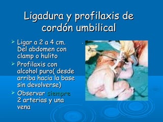 Ligadura y profilaxis deLigadura y profilaxis de
cordón umbilicalcordón umbilical
 Ligar a 2 a 4 cm.Ligar a 2 a 4 cm.
Del abdomen conDel abdomen con
clamp o hulitoclamp o hulito
 Profilaxis conProfilaxis con
alcohol puro( desdealcohol puro( desde
arriba hacia la basearriba hacia la base
sin devolverse)sin devolverse)
 ObservarObservar siempresiempre
2 arterias y una2 arterias y una
venavena
..
 