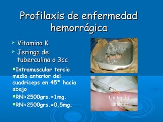 Profilaxis de enfermedadProfilaxis de enfermedad
hemorrágicahemorrágica
 Vitamina KVitamina K
 Jeringa deJeringa de
tuberculina o 3cctuberculina o 3cc
Un tercio
anterior
Intramuscular tercio
medio anterior del
cuadriceps en 45º hacia
abajo
RN>2500grs.=1mg.
RN<2500grs.=0,5mg.
 