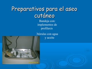 Preparativos para el aseoPreparativos para el aseo
cutáneocutáneo
Bandeja con:
implementos de
profilaxis
3tórulas con agua
y aceite
 