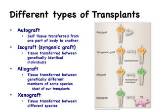 Isograft Examples 15_autoimmunity_and_transplantation.pdf. | PDF