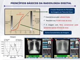  Caracteriza-se pela Latitude Ampla.
 Resultam nos 10.000 níveis de cinza.
 A imagem com filme convencional pode
apresentar apenas 30 tons de cinza.
Função Resposta do Receptor
de Imagem em Tons de Cinza
PRINCÍPIOS BÁSICOS DA RADIOLOGIA DIGITAL
Curva Característica da Imagem
 