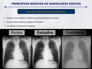  Reduzir o ruído; Ajustar e otimizar as características de contraste;
 Extrair características de regiões de interesse;
 Aumentar a visibilidade de detalhes;
PROCESSAMENTO DA IMAGEM DIGITAL
PRINCÍPIOS BÁSICOS DA RADIOLOGIA DIGITAL
 