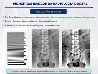  É a Capacidade de um sistema de imagem em determinar e mostrar um pequeno objeto de alto contraste;
 PL/mm : Pares de Linhas por Milímetro (Frequência Espacial);
 A Resolução Espacial na Radiologia Digital é Limitada pelo Pixel;
PRINCÍPIOS BÁSICOS DA RADIOLOGIA DIGITAL
RESOLUÇÃO ESPACIAL
 Quanto Maior a Resolução Espacial Menor será o Contraste Devido ao Borramento;
 
