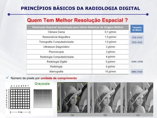Quem Tem Melhor Resolução Espacial ?
PRINCÍPIOS BÁSICOS DA RADIOLOGIA DIGITAL
 Número de pixels por unidade de comprimento
 
