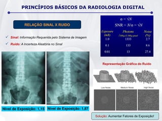  Sinal: Informação Requerida pelo Sistema de Imagem
 Ruído: A Incerteza Aleatória no Sinal
Solução: Aumentar Fatores de Exposição!
PRINCÍPIOS BÁSICOS DA RADIOLOGIA DIGITAL
RELAÇÃO SINAL X RUIDO
Representação Gráfica do Ruído
 