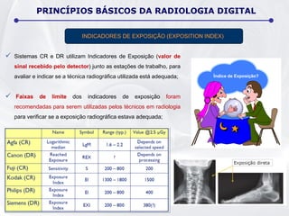  Sistemas CR e DR utilizam Indicadores de Exposição (valor de
sinal recebido pelo detector) junto as estações de trabalho, para
avaliar e indicar se a técnica radiográfica utilizada está adequada;
 Faixas de limite dos indicadores de exposição foram
recomendadas para serem utilizadas pelos técnicos em radiologia
para verificar se a exposição radiográfica estava adequada;
INDICADORES DE EXPOSIÇÃO (EXPOSITION INDEX)
Índice de Exposição?
PRINCÍPIOS BÁSICOS DA RADIOLOGIA DIGITAL
 