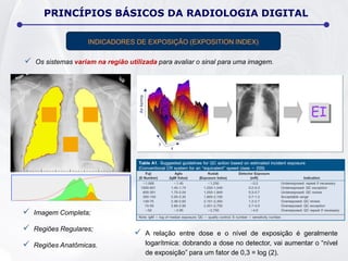  Os sistemas variam na região utilizada para avaliar o sinal para uma imagem.
 Imagem Completa;
 Regiões Regulares;
 Regiões Anatômicas.
 A relação entre dose e o nível de exposição é geralmente
logarítmica: dobrando a dose no detector, vai aumentar o “nível
de exposição” para um fator de 0,3 = log (2).
PRINCÍPIOS BÁSICOS DA RADIOLOGIA DIGITAL
INDICADORES DE EXPOSIÇÃO (EXPOSITION INDEX)
 