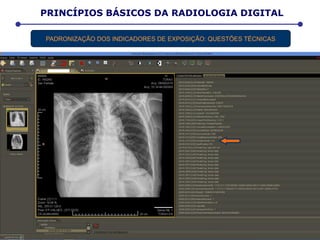 PADRONIZAÇÃO DOS INDICADORES DE EXPOSIÇÃO: QUESTÕES TÉCNICAS
PRINCÍPIOS BÁSICOS DA RADIOLOGIA DIGITAL
 