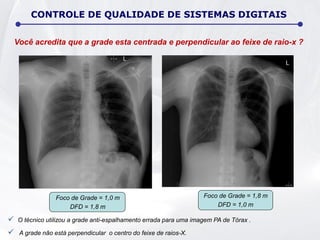 Foco de Grade = 1,0 m
DFD = 1,8 m
Você acredita que a grade esta centrada e perpendicular ao feixe de raio-x ?
 O técnico utilizou a grade anti-espalhamento errada para uma imagem PA de Tórax .
 A grade não está perpendicular o centro do feixe de raios-X.
CONTROLE DE QUALIDADE DE SISTEMAS DIGITAIS
Foco de Grade = 1,8 m
DFD = 1,0 m
 
