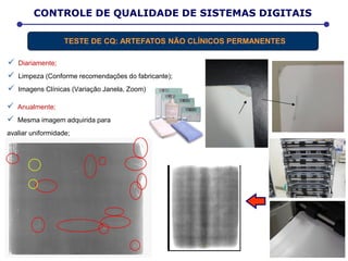  Diariamente;
 Limpeza (Conforme recomendações do fabricante);
 Imagens Clínicas (Variação Janela, Zoom)
D E T E R M I N A Ç Ã O D A D O S E E F E T I V A
CONTROLE DE QUALIDADE DE SISTEMAS DIGITAIS
TESTE DE CQ: ARTEFATOS NÃO CLÍNICOS PERMANENTES
 Anualmente;
 Mesma imagem adquirida para
avaliar uniformidade;
 