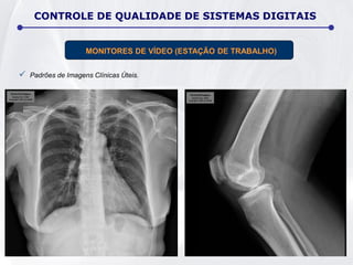 CONTROLE DE QUALIDADE DE SISTEMAS DIGITAIS
MONITORES DE VÍDEO (ESTAÇÃO DE TRABALHO)
 Padrões de Imagens Clínicas Úteis.
 