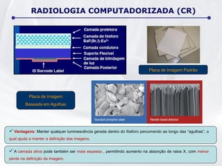 RADIOLOGIA COMPUTADORIZADA (CR)
 Vantagens: Manter qualquer luminescência gerada dentro do fósforo percorrendo ao longo das “agulhas”, o
qual ajuda a manter a definição das imagens.
 A camada ativa pode também ser mais espessa , permitindo aumento na absorção de raios X, com menor
perda na definição da imagem.
Placa de Imagem Padrão
Placa de Imagem
Baseada em Agulhas
 