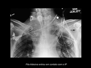 Fita Adesiva entrou em contato com o IP
 