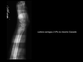 Leitora carregou 2 IPs no mesmo Cassete
 