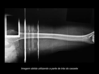 Imagem obtida utilizando a parte de trás do cassete
 