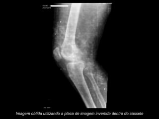 Imagem obtida utilizando a placa de imagem invertida dentro do cassete
 