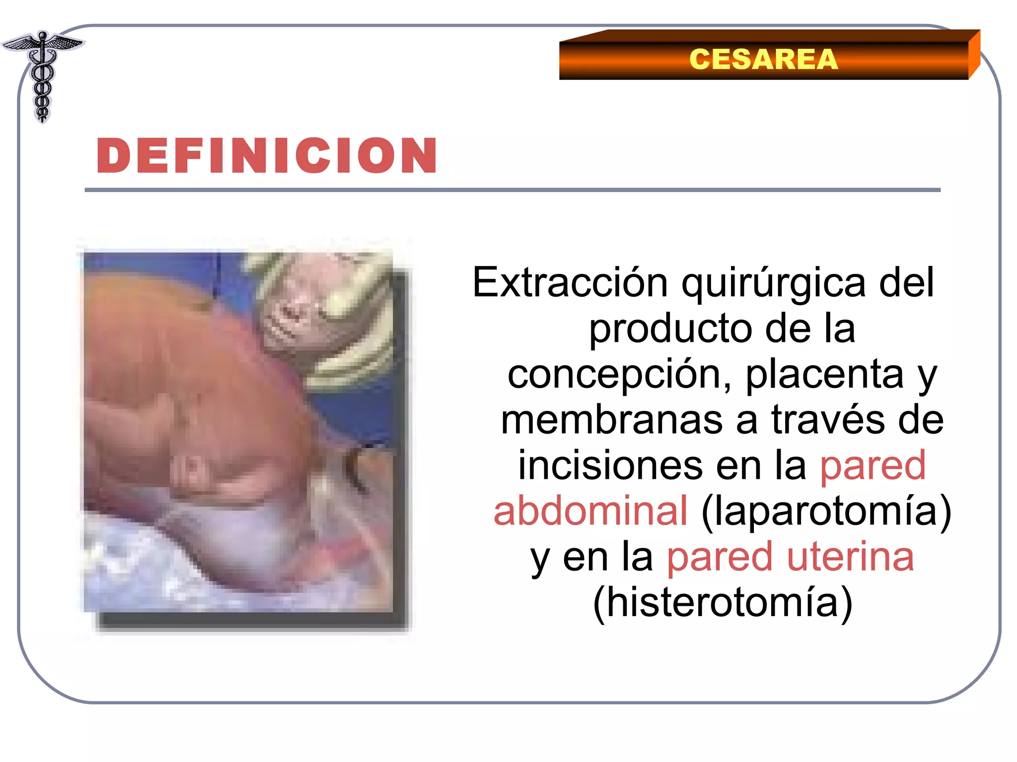 DEFINICION Extracción quirúrgica del producto de la concepción, placenta y membranas a través de incisiones en la  pared abdominal  (laparotomía) y en la  pared uterina  (histerotomía) CESAREA 